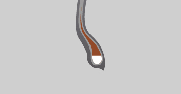 Vantra LT bead filler